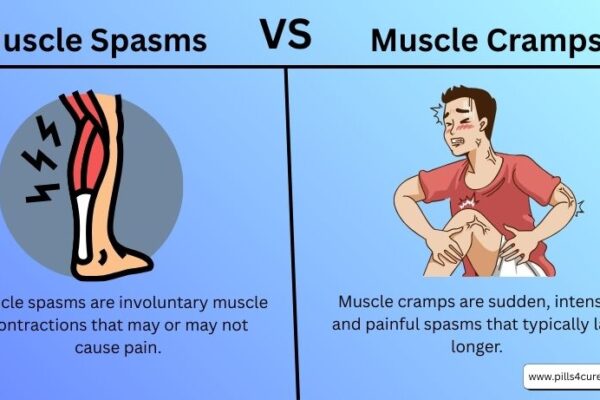 muscle spasms vs muscle cramps