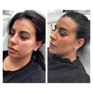 skin clinic Richmond
